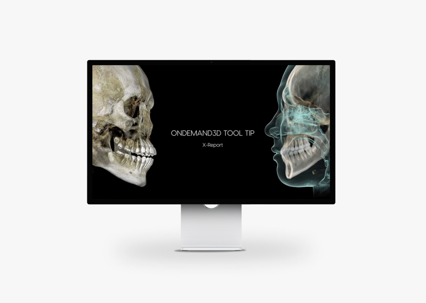 HDX WILL DENTRI-a 3D, FOV 18 × 16,5 см, без цефалостата