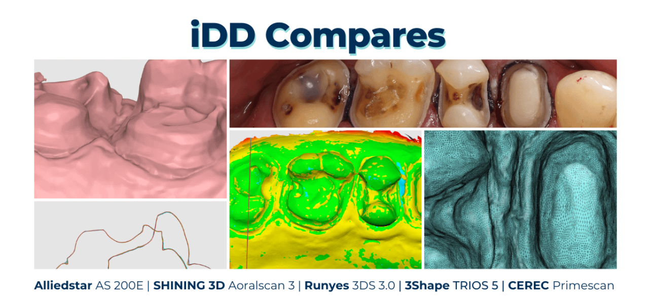 Сравнение доступных и дорогих внутриротовых сканеров для стоматологии!