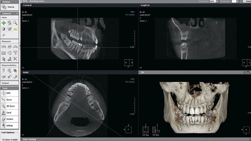 PointNix Point 3D Combi, FOV 16 × 15 см, без цефалостата PointNix Point 3D Combi, FOV 16 × 15 см, без цефалостата