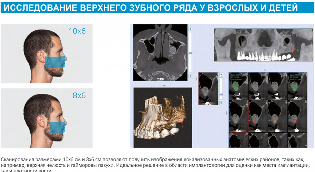 Примеры исследования верхнего зубного ряда
