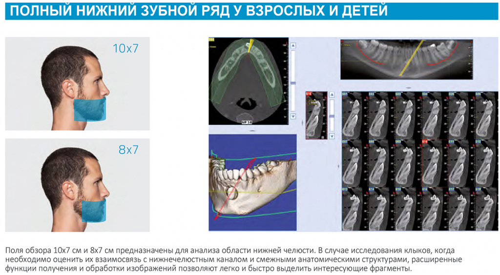 Примеры исследования нижнего зубного ряда у взрослых и детей