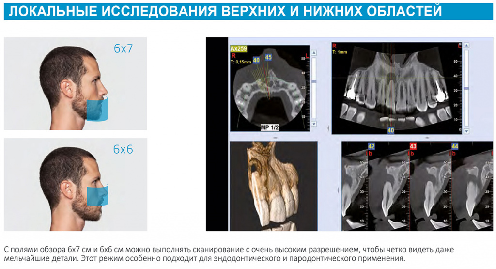 Примеры локальных 3D-исследований