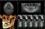 Томограф Meyer 3D Pro 16x10 
