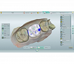 MyCrown CAD/CAM