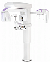 MyRay Hyperion X9 PRO, FOV 13 × 16 см, без цефалостата