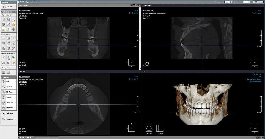 PointNix Point 3D Combi 500C, FOV 10 × 9 см, с цефалостатом