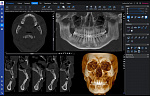 Planmeca ProMax 3D Mid с цефалостатом (20x17) 
