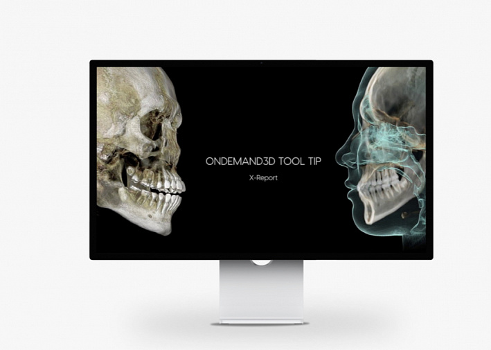 HDX WILL DENTRI-Ca 3D ECO-X, FOV 12 × 10 см