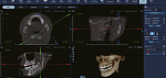 Дентальный 3D томограф EighTeeth FinScan F350 16x10 с ПК, 3 года гарантия