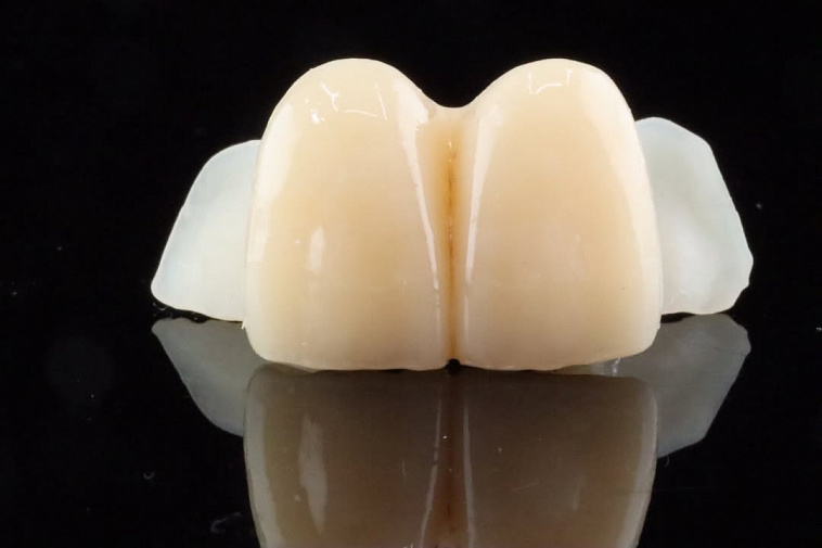 Стоматологический 3D принтер Edge Mini RayShape