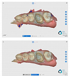 Интраоральный 3D сканер Runyes IOS-11 V3