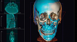 Томограф OP 3D Vision V10, (16*10)