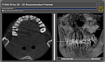Дентальный цифровой томограф FONA XPan 3D (8,5x8,5)