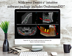 Дентальный томограф HDX Dentri 3D Classic SE (16x14,5)