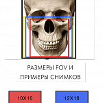 PointNix Point 3D Combi 500C, FOV 12 × 9 см, с цефалостатом