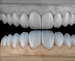 Фрезерный станок Besmile BSM-500D, 5 осей, сухая обработка