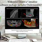 HDX WILL DENTRI-a 3D, FOV 18 × 16,5 см, без цефалостата