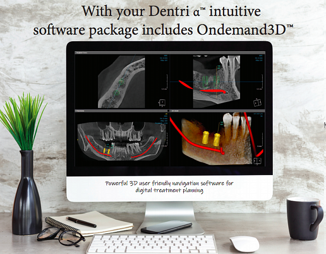 HDX WILL DENTRI-a 3D, FOV 18 × 16,5 см, без цефалостата