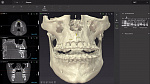 Томограф OP 3D Vision V8, (8*8)
