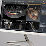 Dentsply Sirona Axeos 3D, FOV до 17 × 13 см, без цефалостата