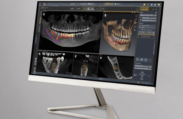 Dentsply Sirona Axeos 3D, FOV до 17 × 13 см, без цефалостата