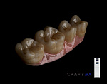 Фрезерный станок CRAFT X5 (цирконий, e-max, Ti абатмент)