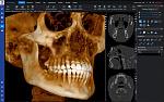 Planmeca ProMax 3D Mid с цефалостатом (20x17) 