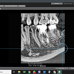 DEXIS OP 3D, PAN, 3D FOV 9 × 14 см и CEPH