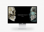 Дентальный томограф HDX Dentri 3D Classic с цефалостатом (16,5x18)