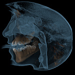 Дентальный томограф GALILEOS 150*150мм + FaceScanner
