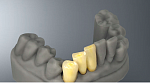 3D Принтер Veltz  D2-120 для стоматологии