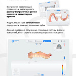 Aoralscan 3 - интраоральный сканер 