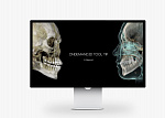 HDX WILL DENTRI-Ca ECO-X, FOV 16 × 10 см, с цефалостатом