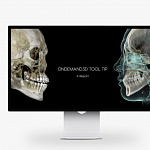 HDX WILL DENTRI-Ca ECO-X, FOV 16 × 10 см, с цефалостатом