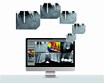Визиограф Zen-X HD с позиционерами