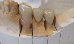 Yenadent D15 MAX - фрезерный станок (2,7 кВт, все виды материалов)
