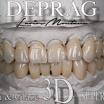 Фрезерный станок Deprag W5 MAX (3 кВт) с авточенджером 8