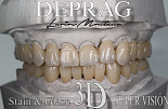 Фрезерный станок Deprag W5 MAX (3 кВт) с авточенджером 8