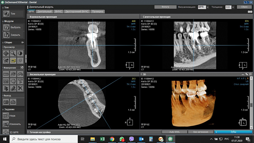 DEXIS OP 3D, PAN, 3D FOV 9 × 14 см и CEPH