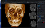 Дентальный 3D томограф Planmeca ProMax 3D Mid  (20x17 см)