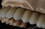 Yenadent D15 MAX - фрезерный станок (2,7 кВт, все виды материалов)