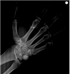 Дентальный томограф Hyperion X5 (10x10) MyRay