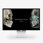 Дентальный томограф HDX Dentri 3D Classic с цефалостатом (16,5x18)