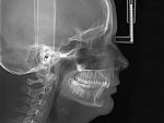 DEXIS OP 3D, PAN, 3D FOV 9 × 14 см и CEPH