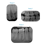 VistaScan Nano Easy - сканер фосфорных пластин Durr Dental