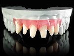 Rapidshape D40 II - 3D-принтер для стоматологии
