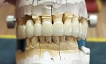 Стоматологический 3Д принтер по металлу 3DLam Mini (CoCr, Ti, Al)