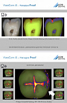 Интраоральная камера VistaCam iX Digital  with Cam Package