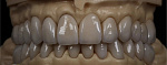 Yenadent D10 MAX - фрезерный станок (Zi, воск, PMMA)