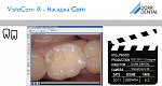 Интраоральная камера VistaCam iX Digital  with Cam Package